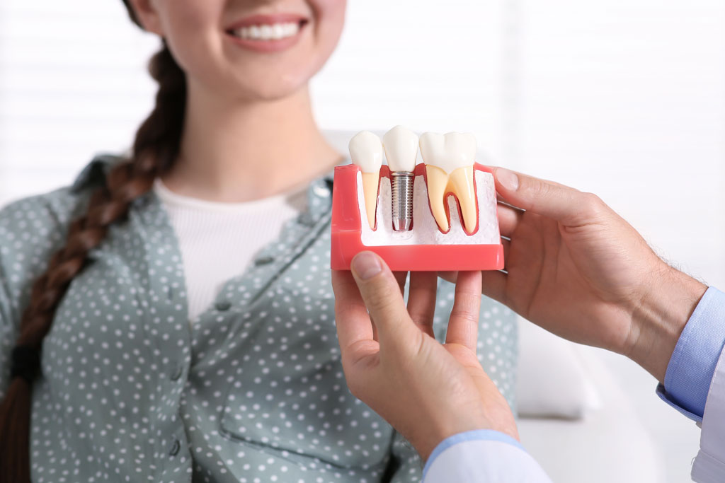 How Many Days to Rest After Getting a Dental Implant Procedure